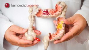 Câncer de intestino