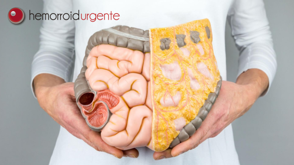 Como é feito o exame de colonoscopia